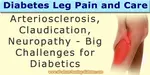 leg pain diabetes