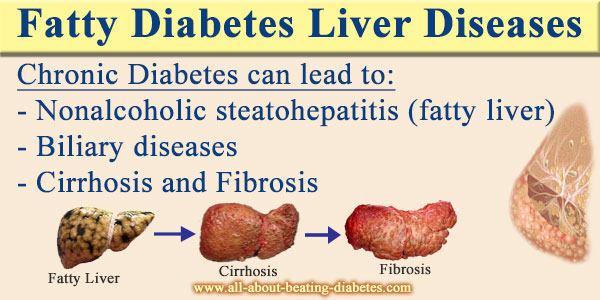 Fatty Diabetes Liver Diseases