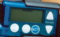 GlucoWatch control diabetes