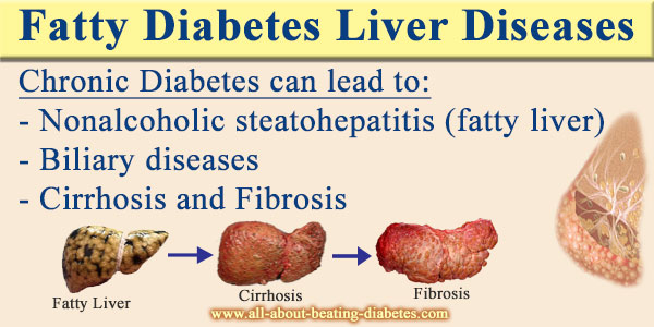 Fatty Diabetes Liver Diseases